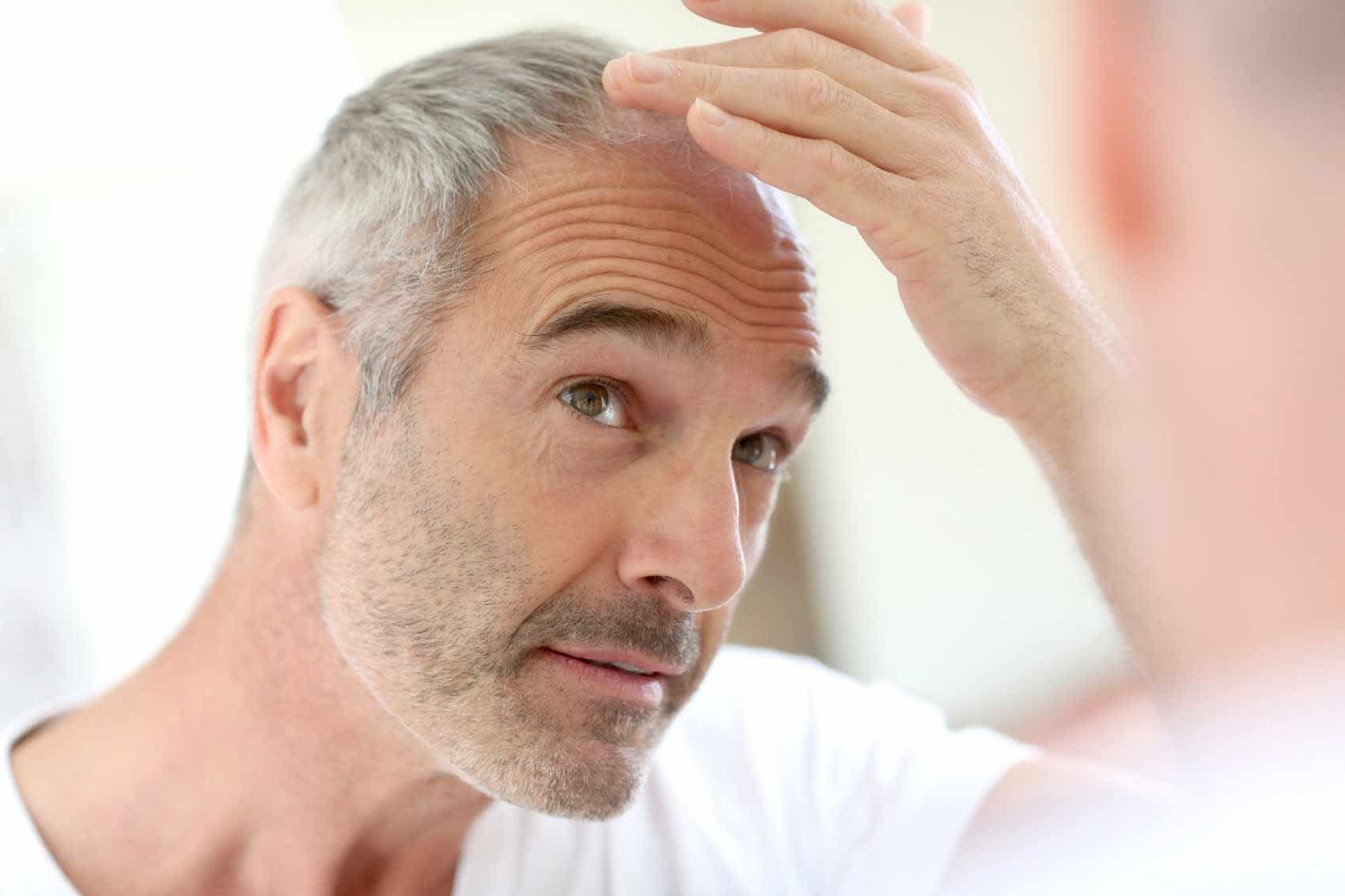 Hair Loss Treatment Myths: What Really Works?
