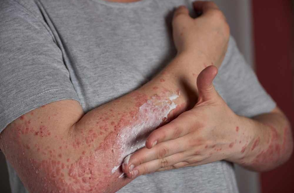 Why Finding the Best Dermatologist for Skin Allergy Matters