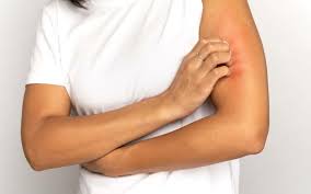 3 Things That Cause Dry Skin