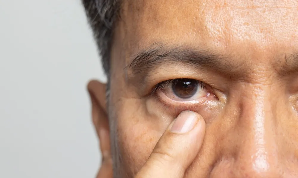 How Ophthalmologists Diagnose and Treat Eye Conditions How Ophthalmologists Diagnose and Treat Eye Conditions