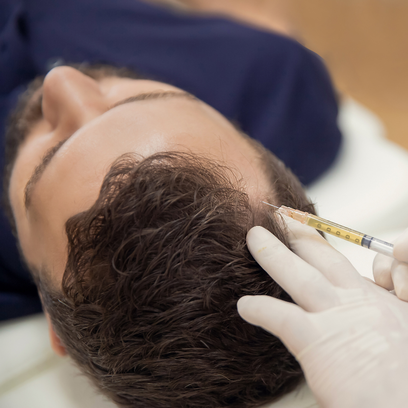 Microneedling for Hair Restoration Microneedling for Hair Restoration