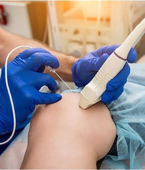 Advances in Sclerotherapy Treatment Techniques Advances in Sclerotherapy Treatment Techniques
