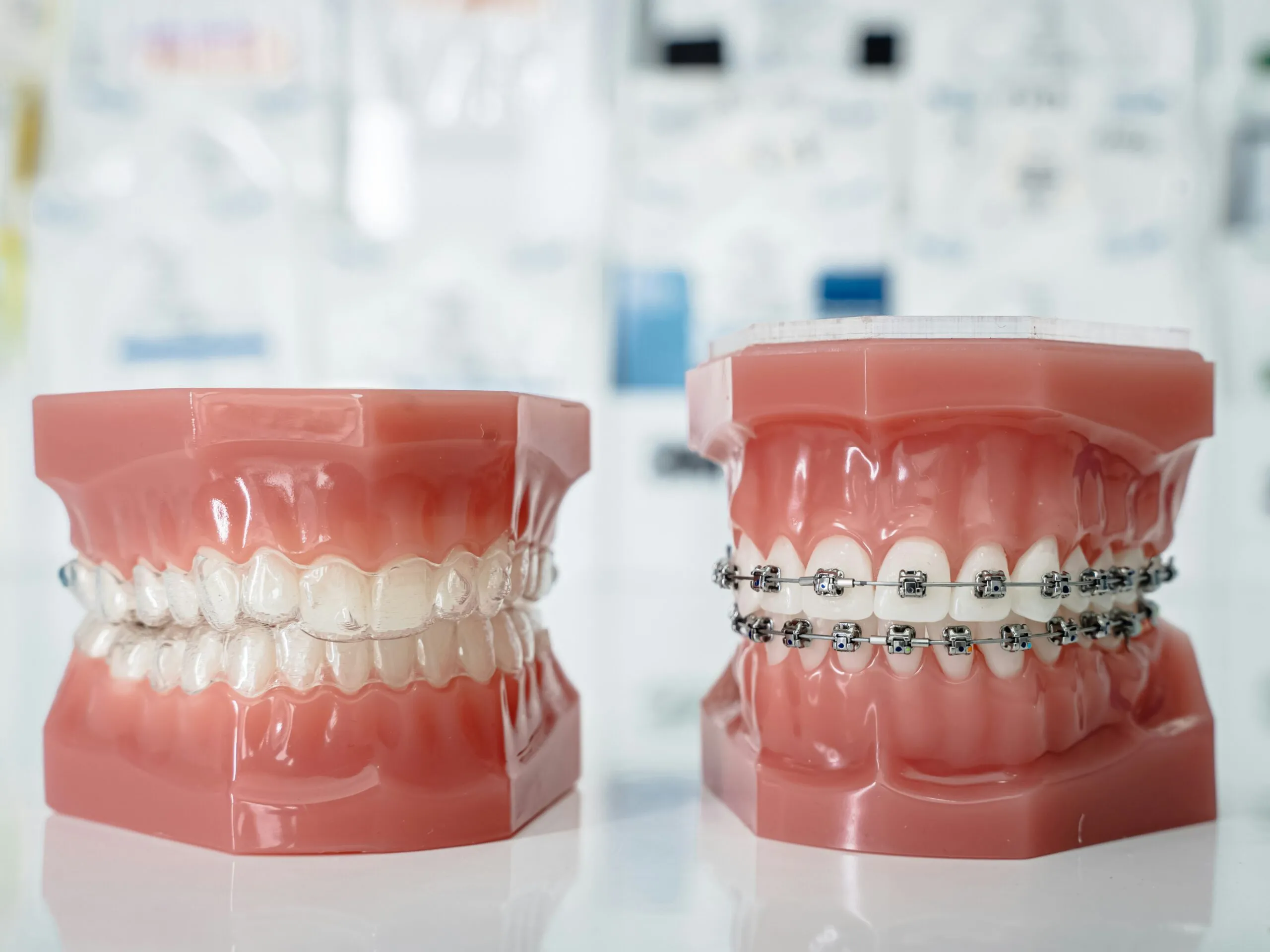 Choosing Between Invisalign and Traditional Braces Choosing Between Invisalign and Traditional Braces