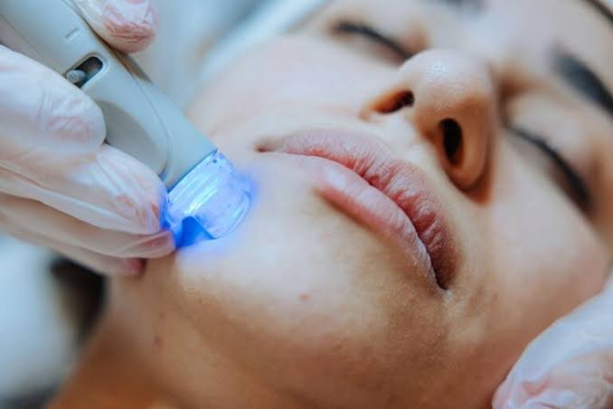 Exploring the Benefits of Laser Treatments for Skin Rejuvenation Exploring the Benefits of Laser Treatments for Skin Rejuvenation