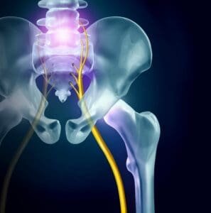 Frequently Asked Questions About Sciatica Issues