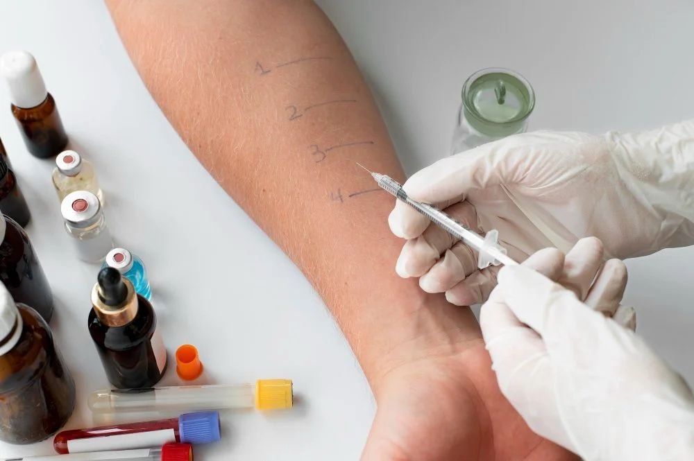How Allergy Testing Can Help Identify Triggers