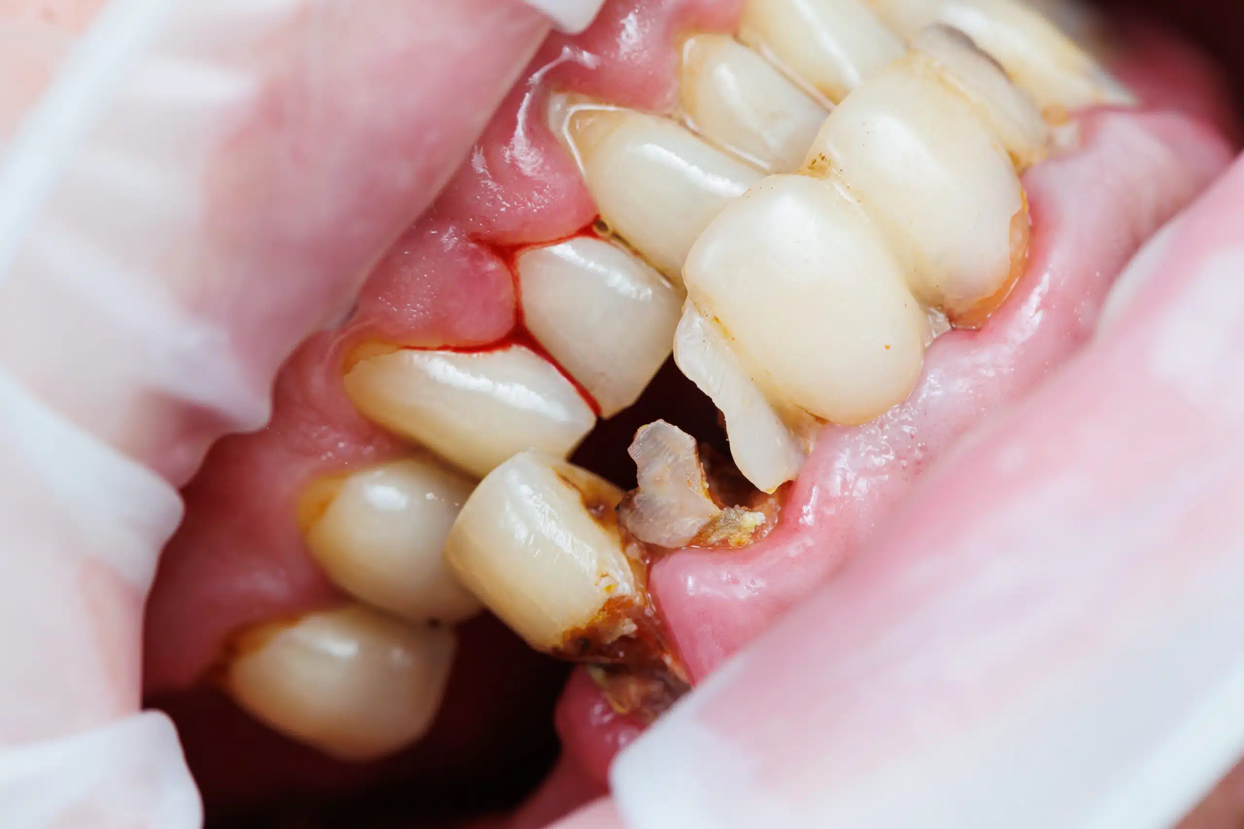How To Handle Dental Emergencies After Hours How To Handle Dental Emergencies After Hours
