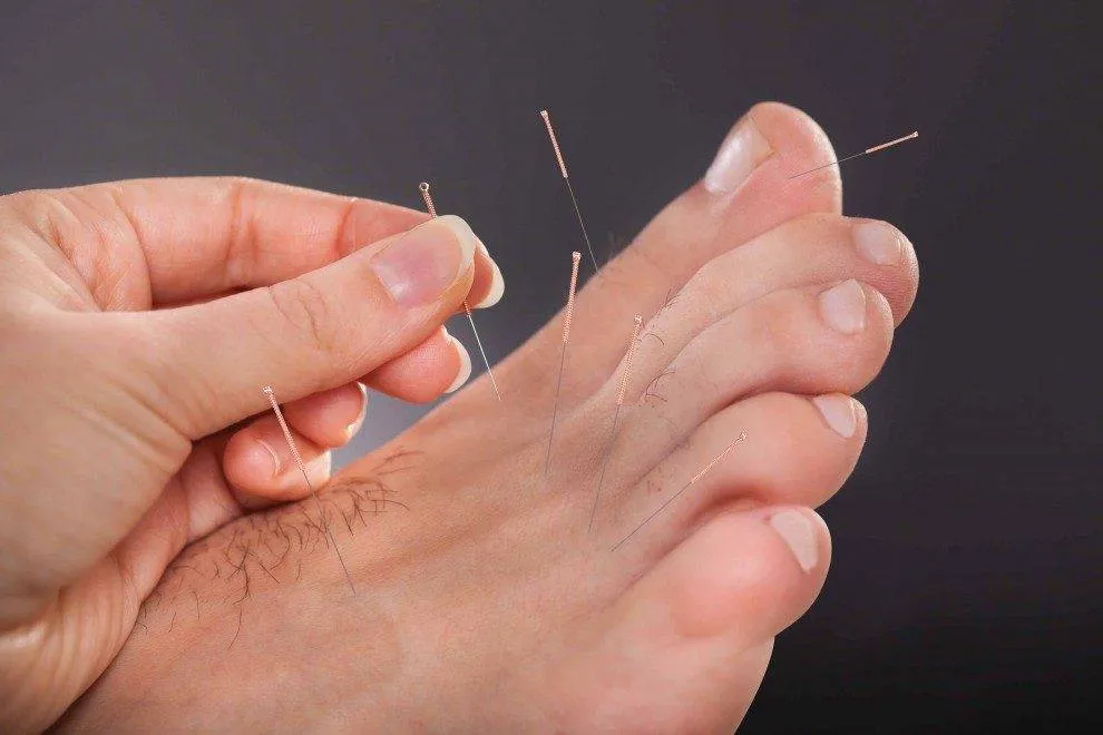 The Latest Advances in Plantar Fasciitis Treatment