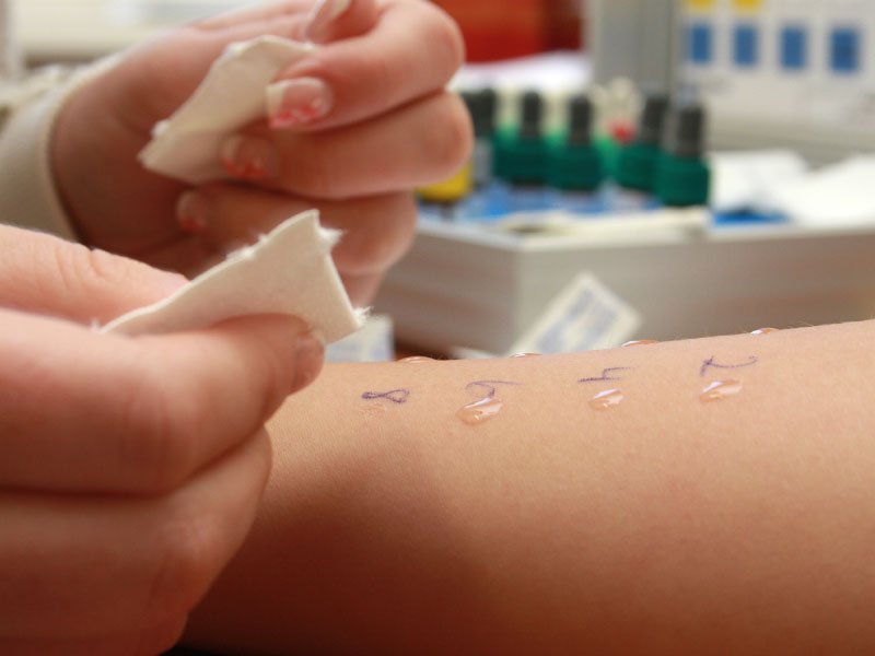 The Role of Allergy Specialists in Allergy Testing and Treatment Plans