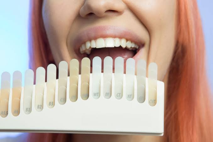 What To Know Before Choosing Dental Veneers What To Know Before Choosing Dental Veneers