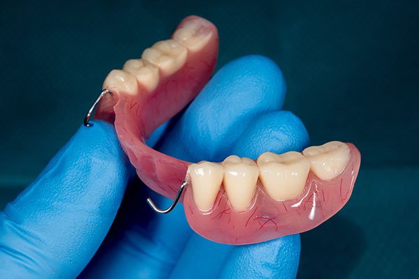 Maintaining Your Dentures To Increase Their Lifespan
