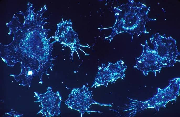 The Role of Urology in Preventing Kidney Stones
