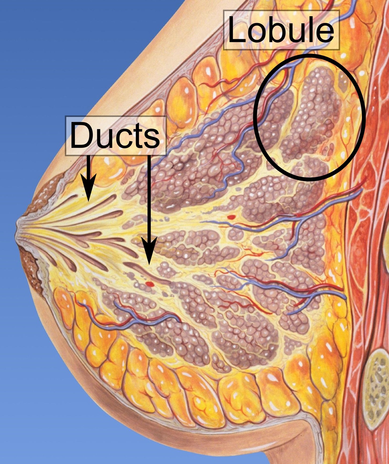 Understanding the Different Types of Breast Tumors